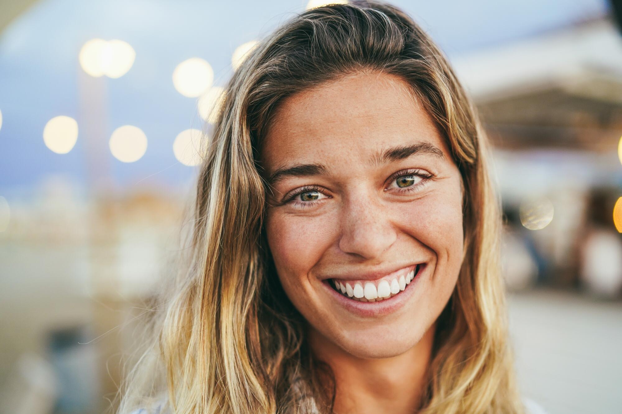 chemical peel process day by day